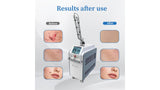 KuAn Technology's Picosecond Holographic Diffraction Laser