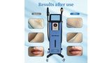 KuAn Beauty Technology Black Swan Multifunctional Hair Removal Device