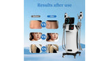 KuAn Technology Cryolipolysis and Muscle Building/Sculpting Device