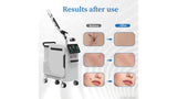 KuAn Technology Starlight Picosecond Laser