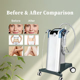 KuAn Technology Vertical Collagen Gun