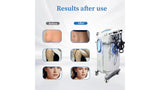 KuAn Technology 80K Fat Burning Device