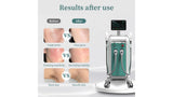 KuAn Technology Laser Hair Removal Device + DPL Multifunctional Beauty Device