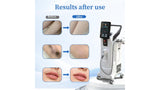 KuAn Technology VL7 Laser Hair Removal Device