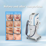 KuAn Technology's New Generation M22 Super Photon Multifunctional Beauty Device