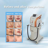 KuAn Technology M22 Ultra-Photon Skin Rejuvenation Device