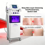 kuAn Technology V3 Comprehensive Skin Device