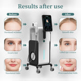 KuAn Technology's Korean HIFU Ultrasonic Focused Anti-Aging Device